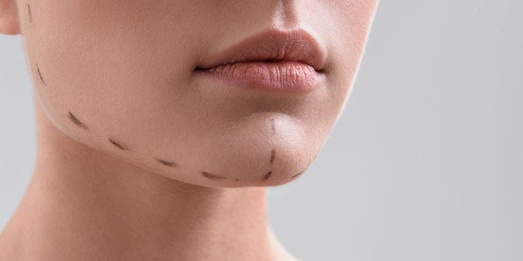 Dr. Ömer Berberoğlu - Çene Kontürü